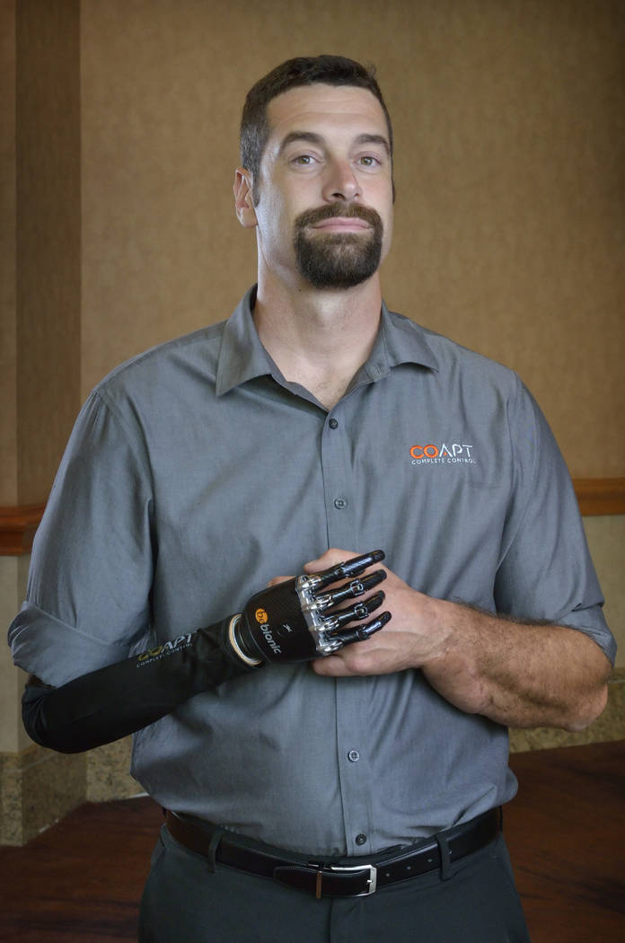 Company provides advanced technology for artificial limbs | Las Vegas ...